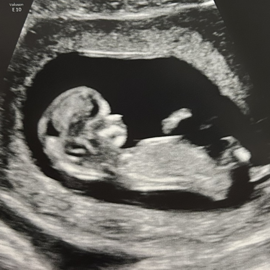 Photo shared by Haily for their Babylist baby registry.