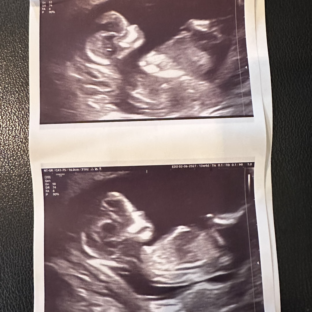 Photo shared by Lourdes for their Babylist baby registry.