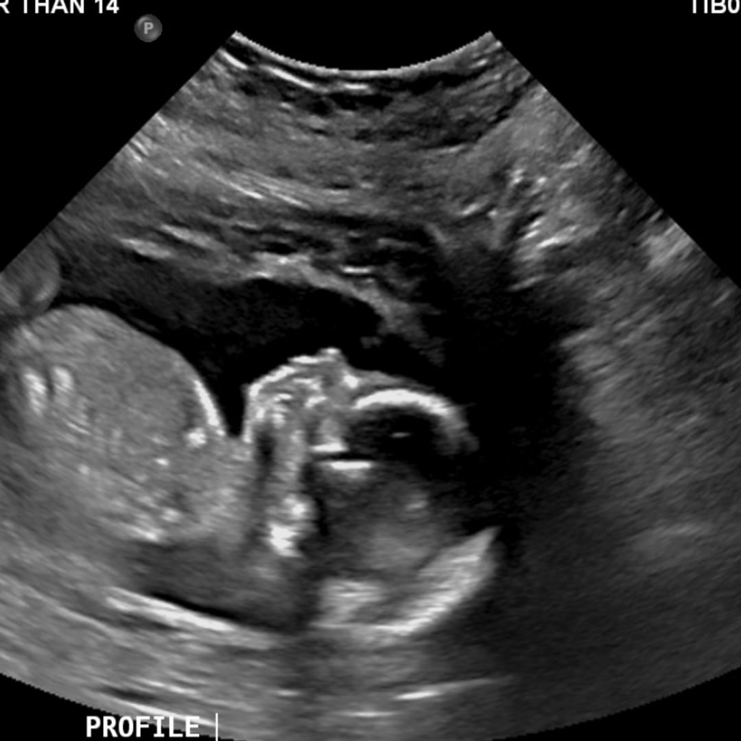 Photo shared by Shelby for their Babylist baby registry.