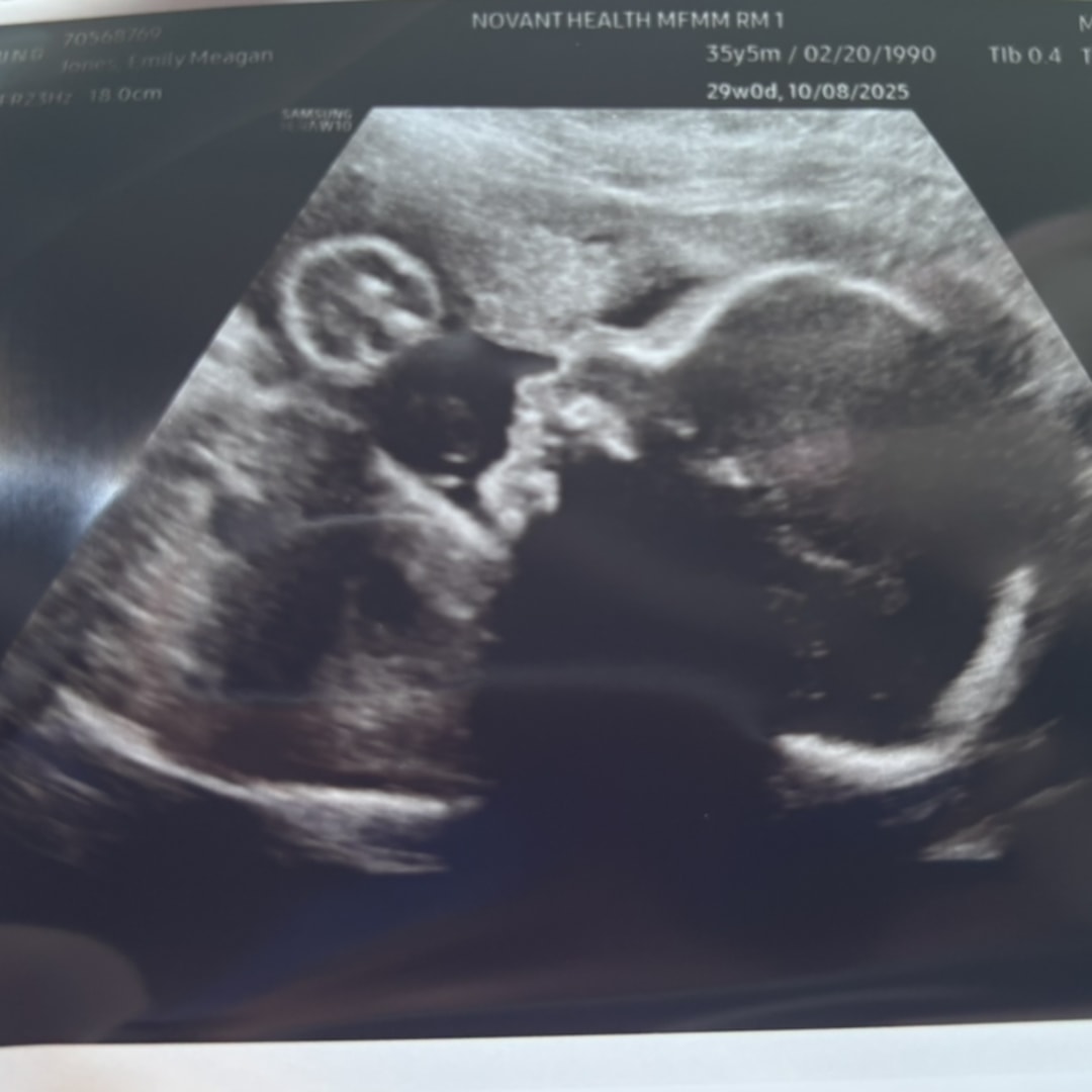 Photo shared by Emily for their Babylist baby registry.
