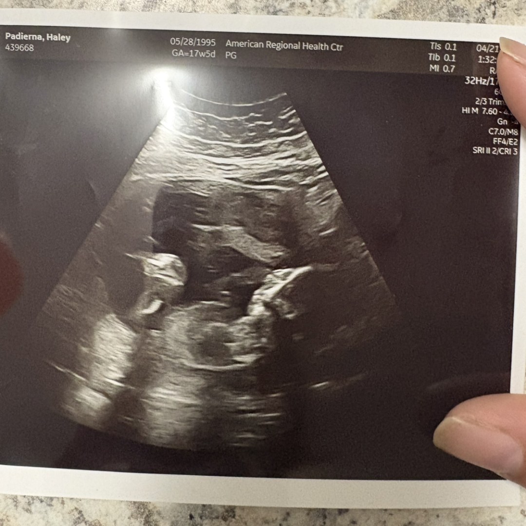 Photo shared by Haley for their Babylist baby registry.