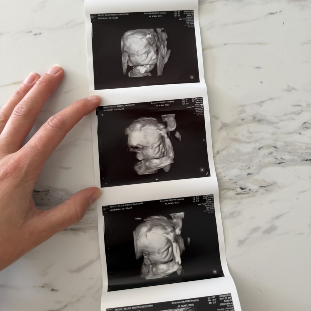 Photo shared by Kelsey for their Babylist baby registry.
