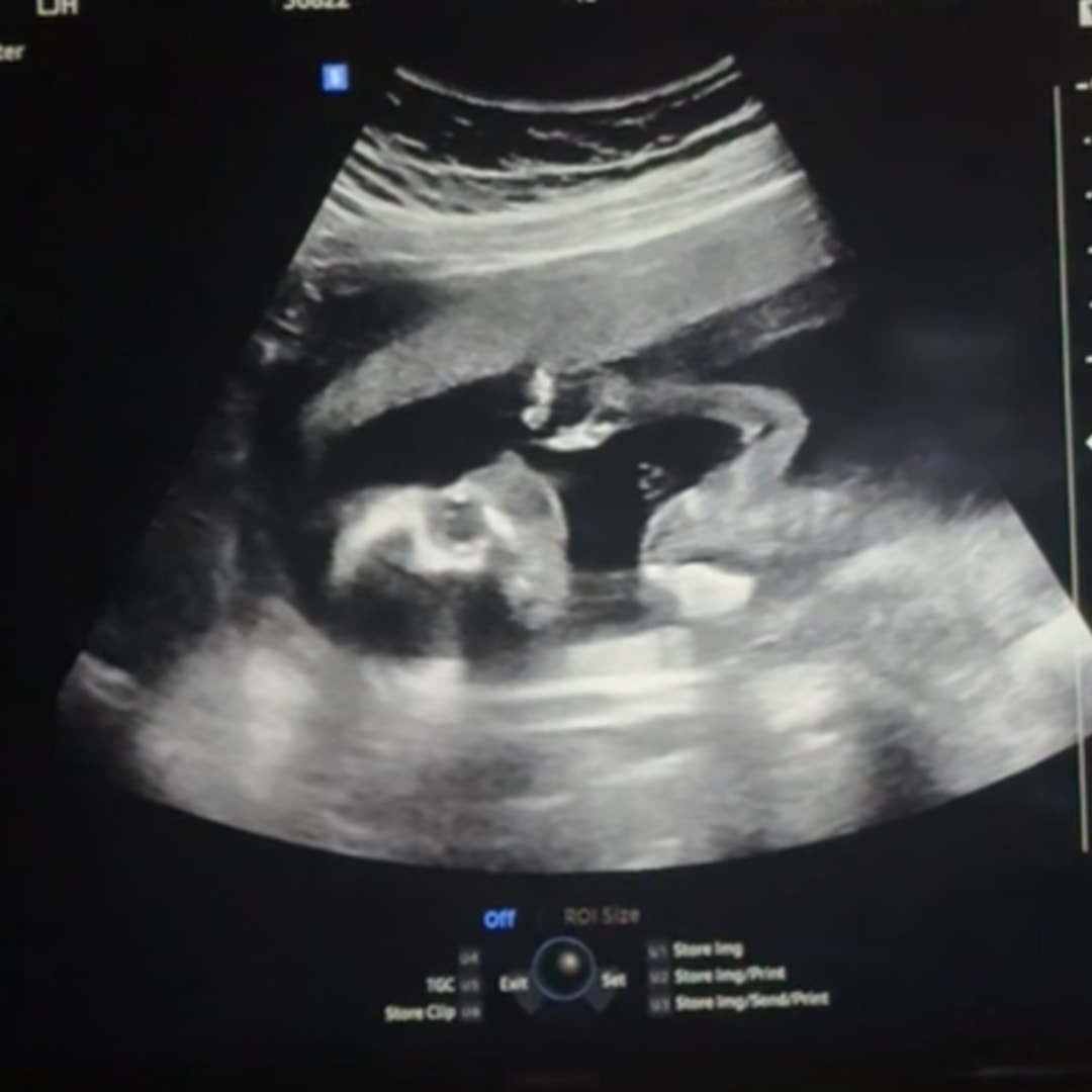 Photo shared by Cathryn for their Babylist baby registry.