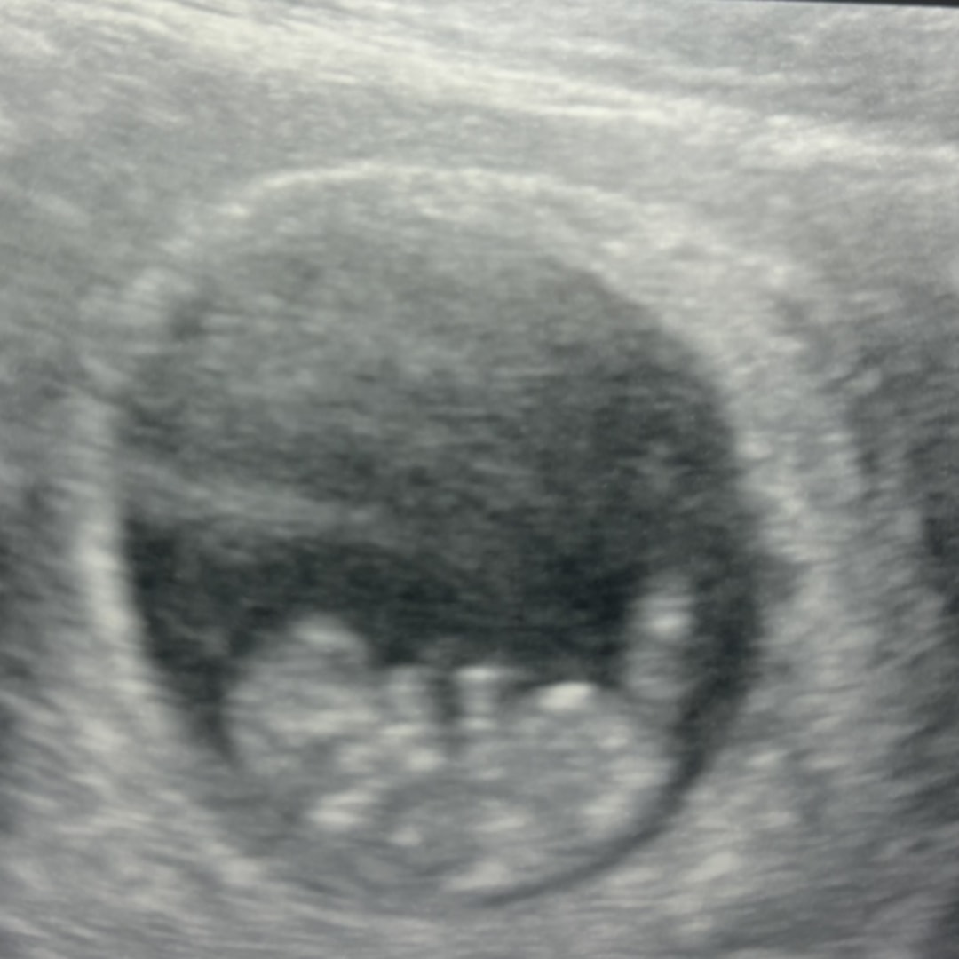 Photo shared by Taya for their Babylist baby registry.