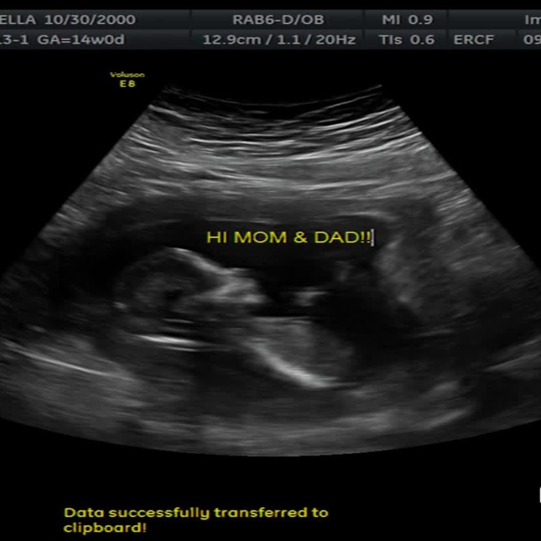 Photo shared by Isabella for their Babylist baby registry.