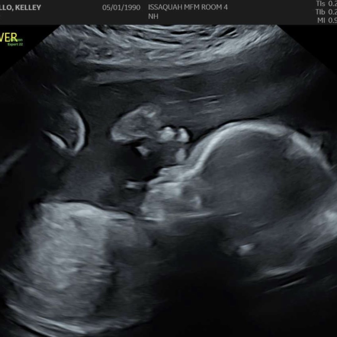 Photo shared by Kelley for their Babylist baby registry.