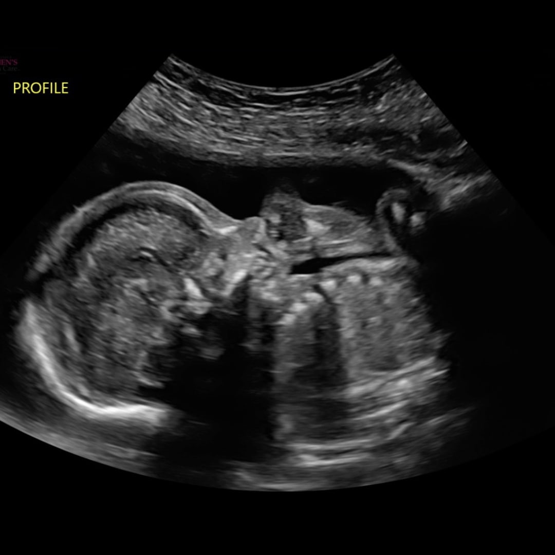Photo shared by Gracelynn for their Babylist baby registry.