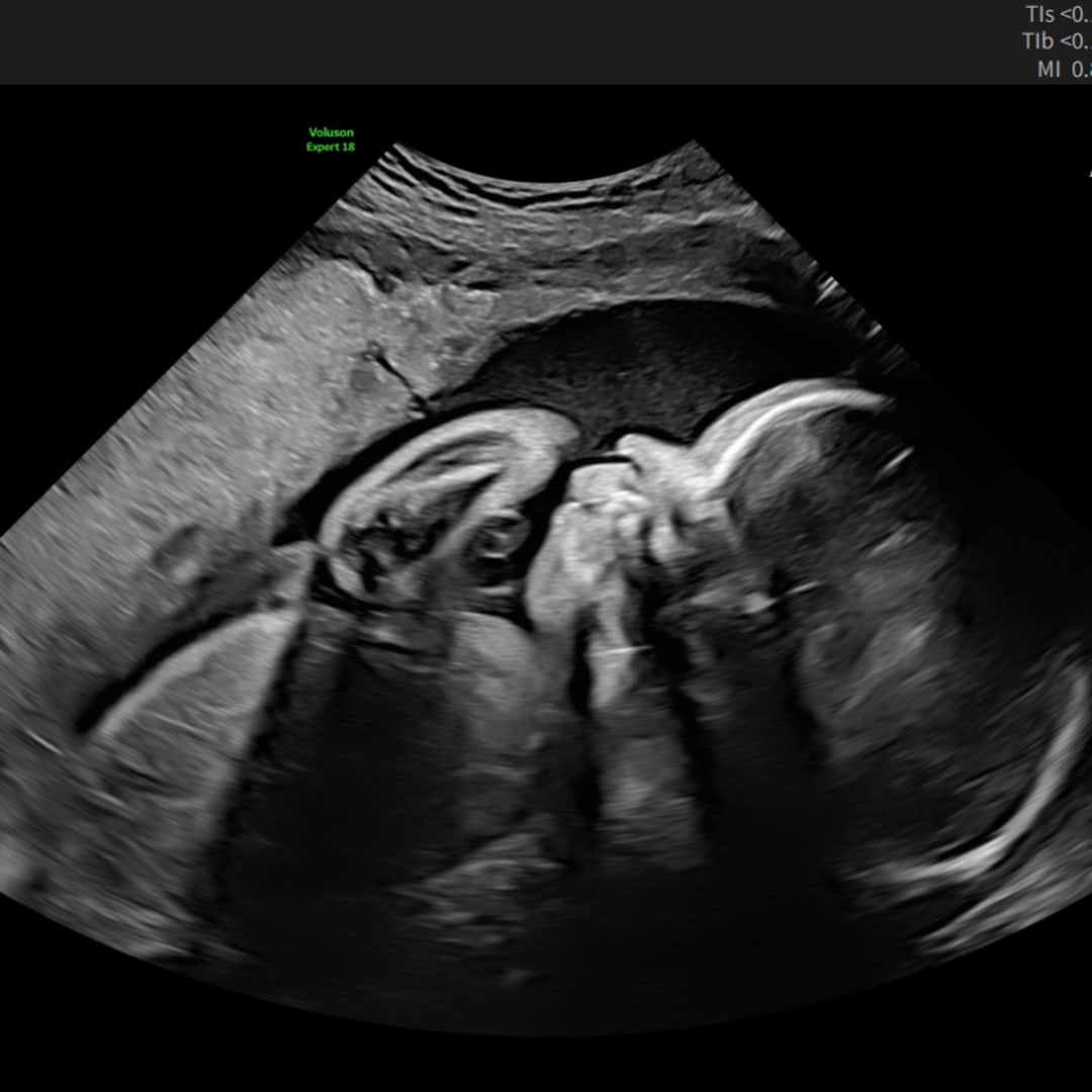 Photo shared by Vic for their Babylist baby registry.