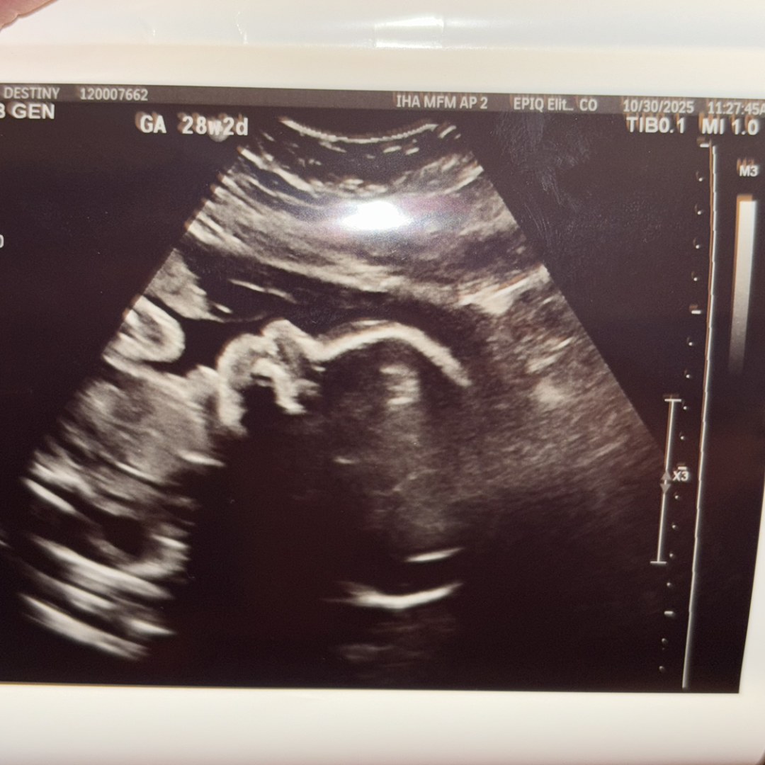 Photo shared by Destiny for their Babylist baby registry.