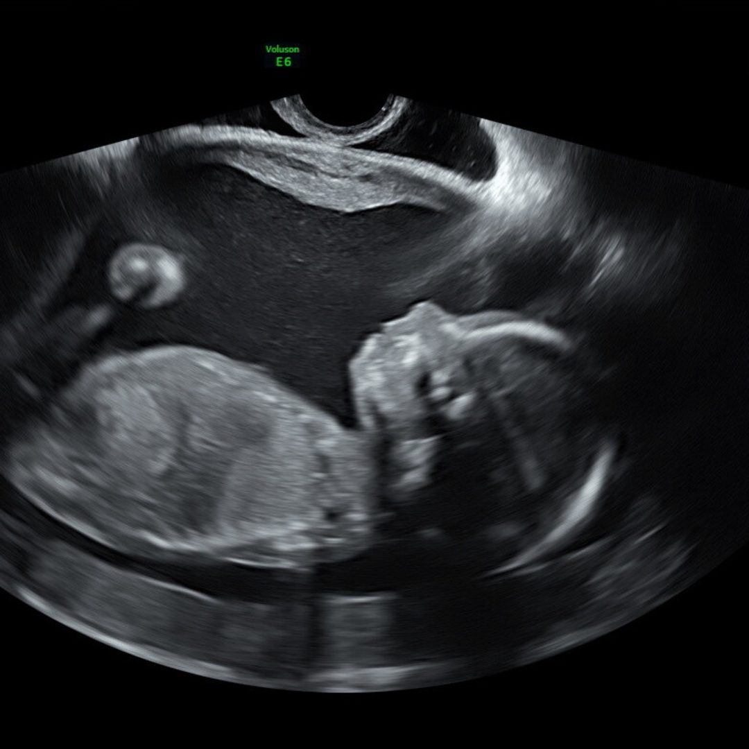 Photo shared by Nicole for their Babylist baby registry.