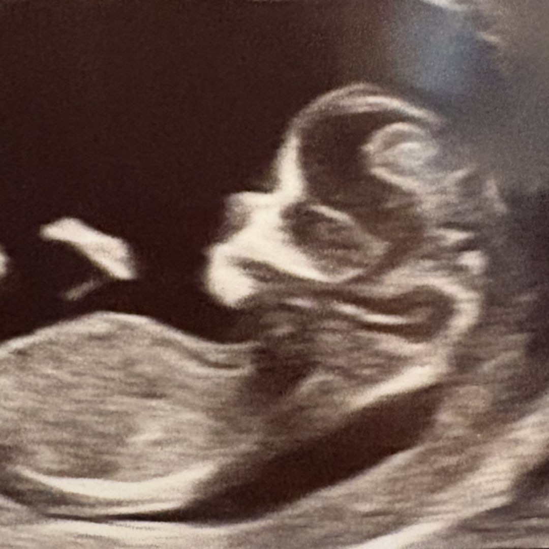 Photo shared by Madison for their Babylist baby registry.