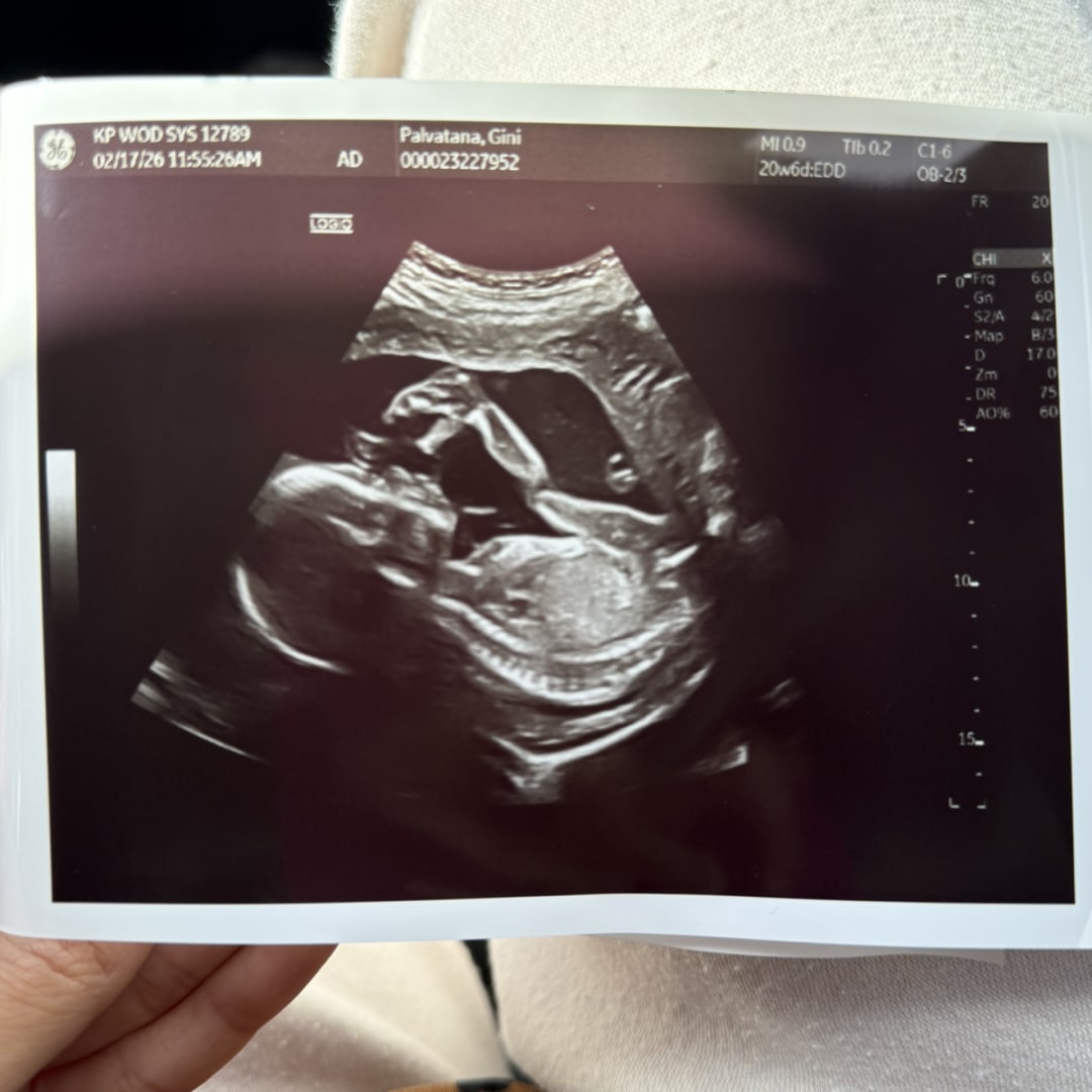 Photo shared by Gini for their Babylist baby registry.