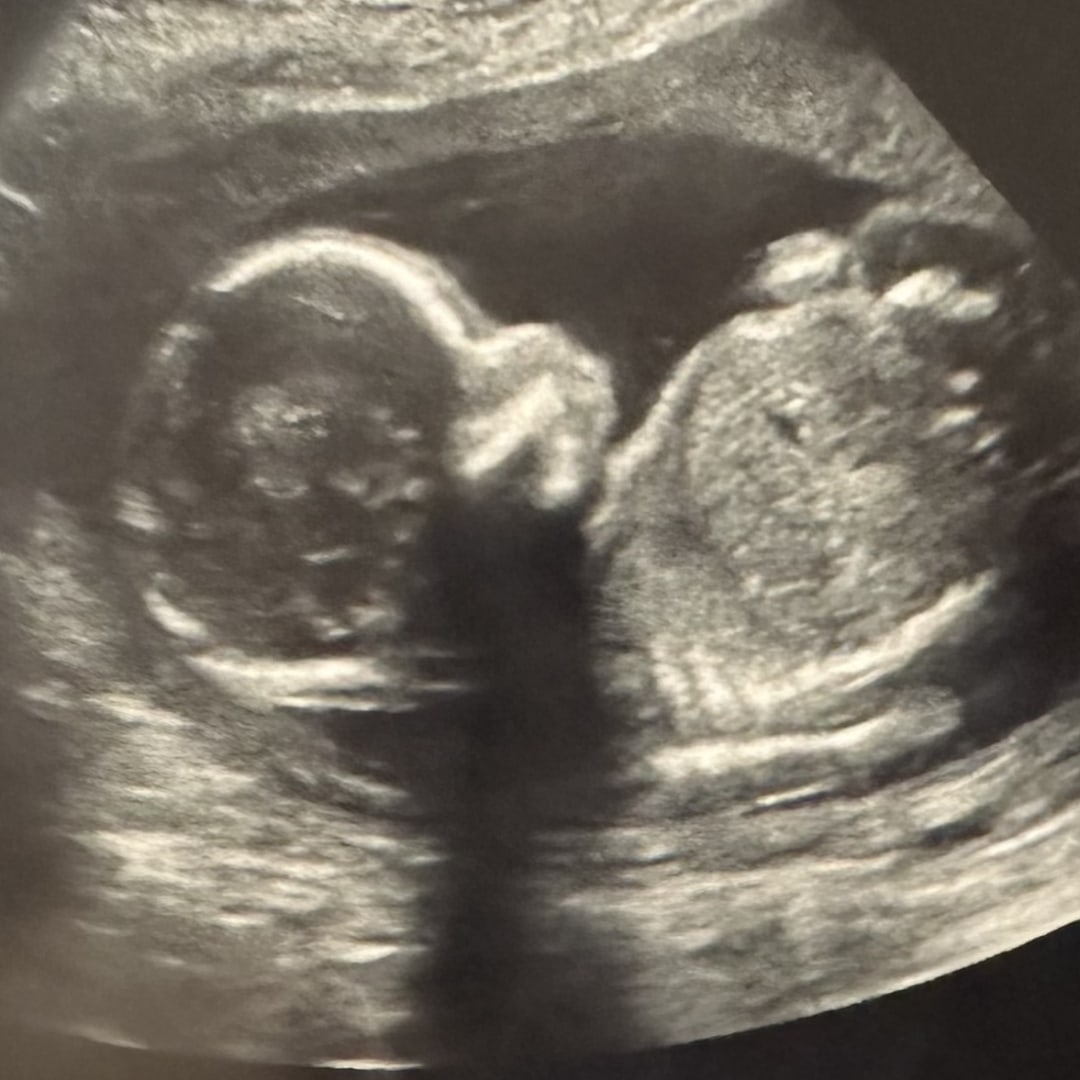 Photo shared by Sheyenne for their Babylist baby registry.