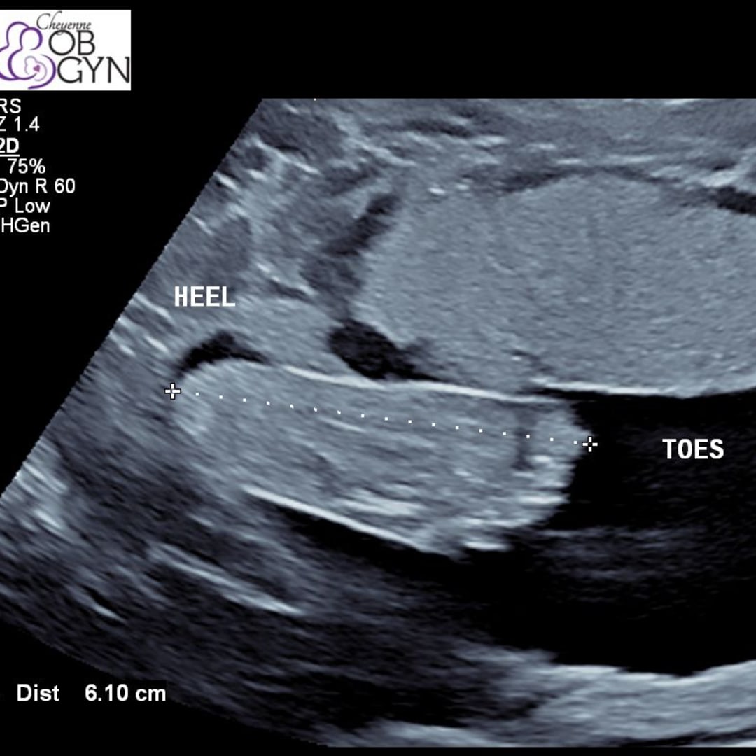 Photo shared by Josie for their Babylist baby registry.