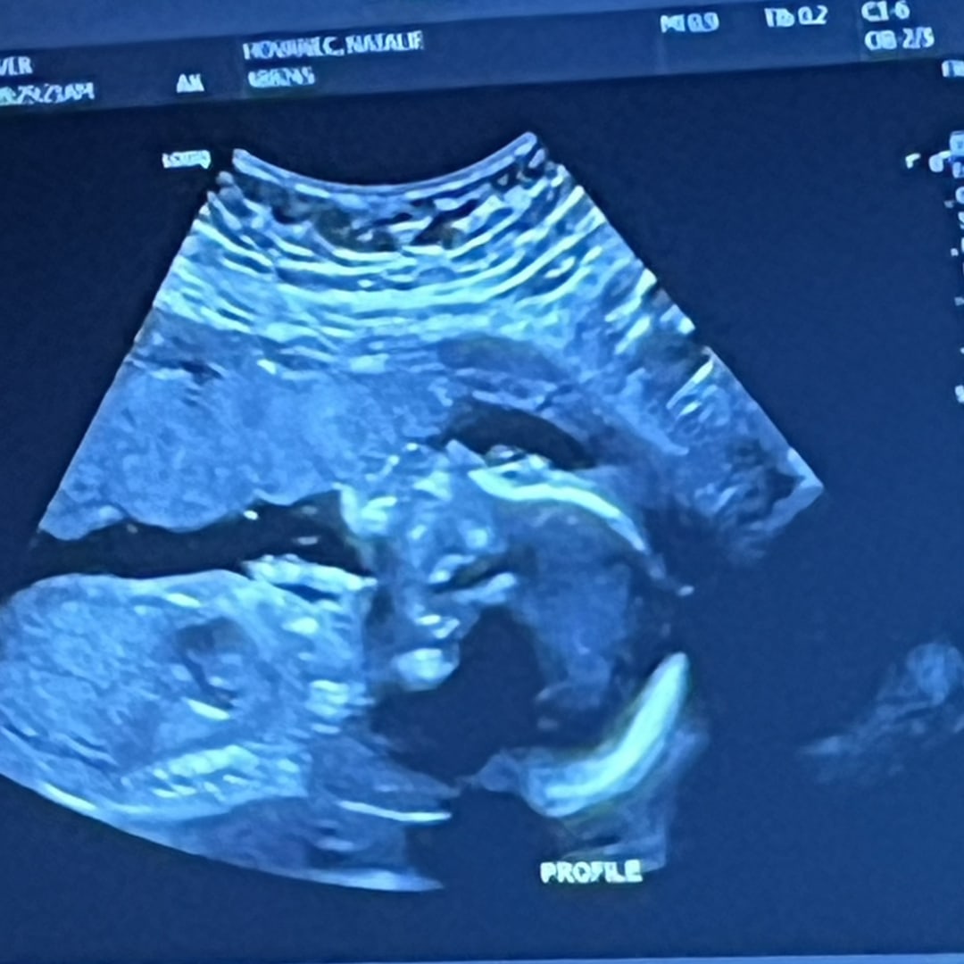 Photo shared by Natalie for their Babylist baby registry.