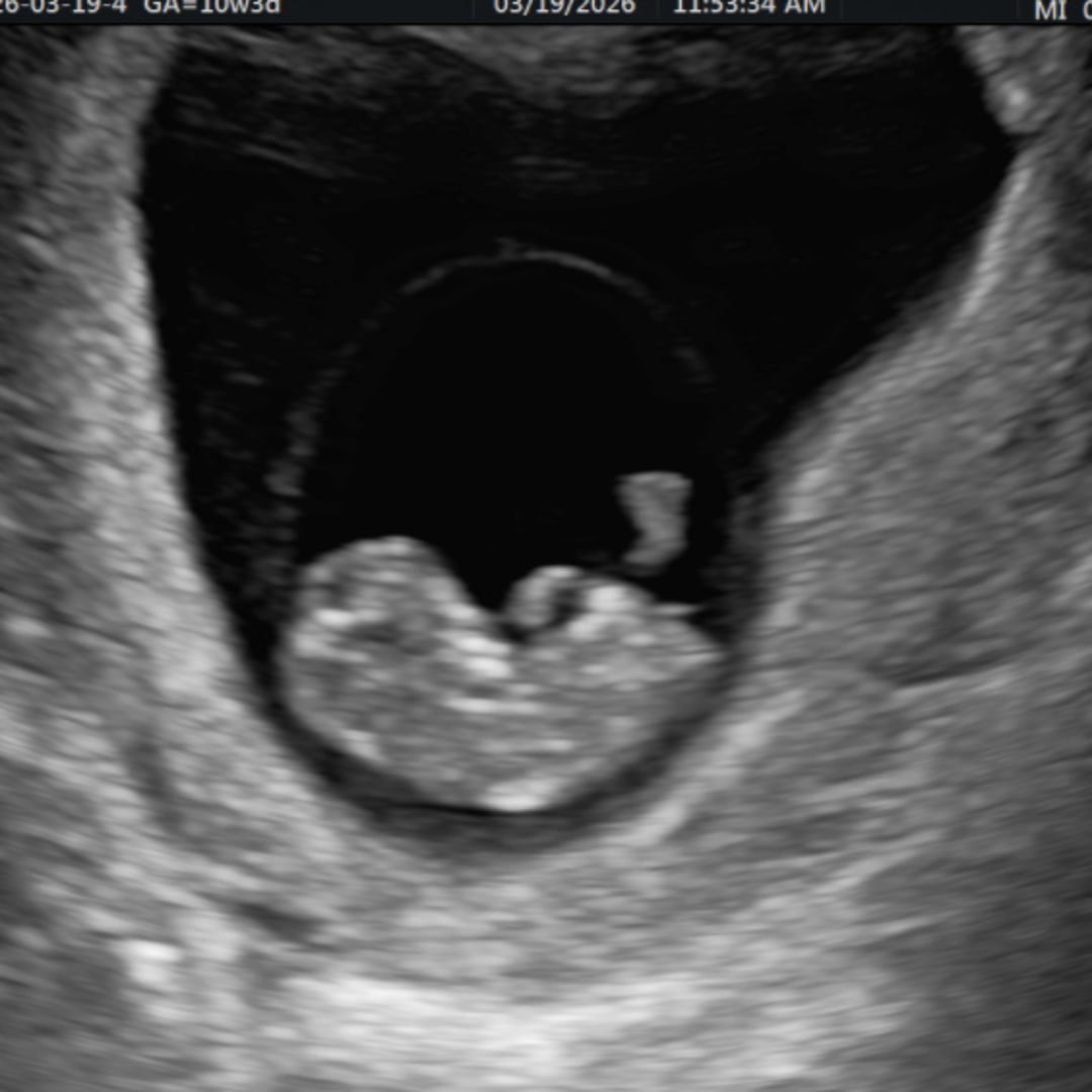 Photo shared by Alexis for their Babylist baby registry.