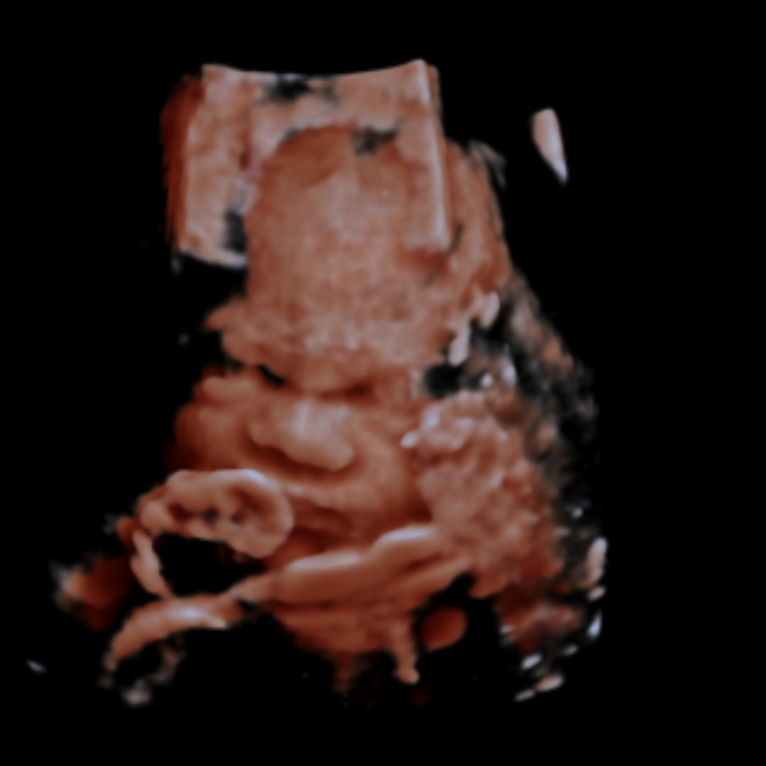 Photo shared by Mya for their Babylist baby registry.