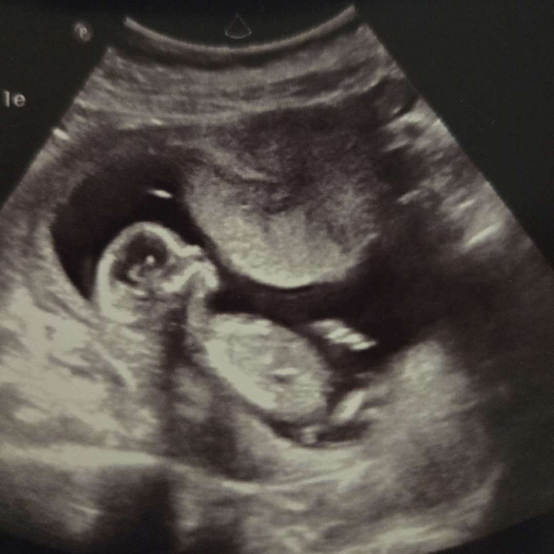 Photo shared by Angie for their Babylist baby registry.