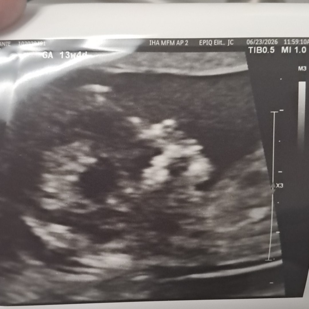 Photo shared by Stephanie for their Babylist baby registry.