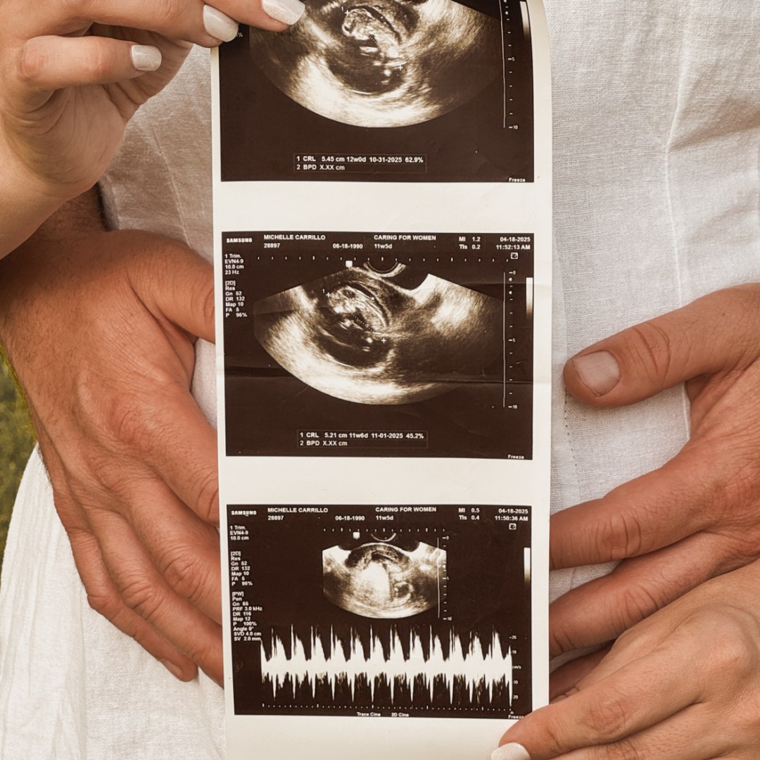 Photo shared by Michelle for their Babylist baby registry.