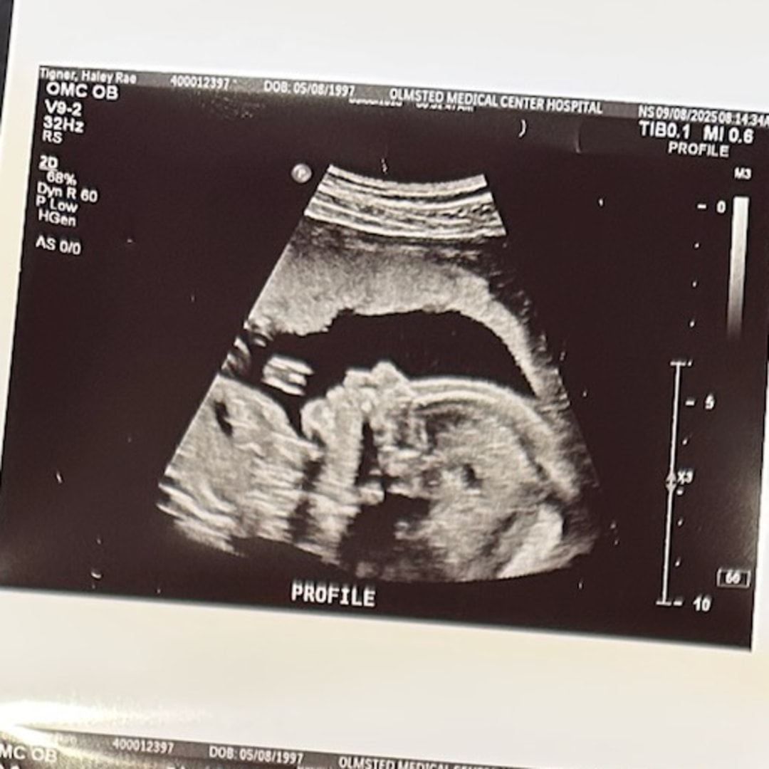 Photo shared by Haley for their Babylist baby registry.