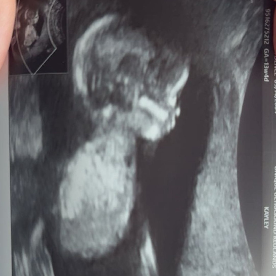 Photo shared by Kaydence for their Babylist baby registry.