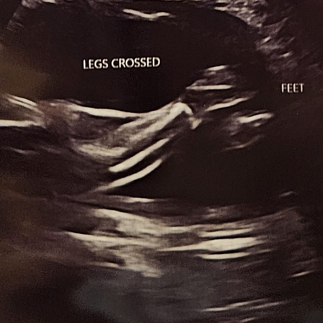 Photo shared by Carina for their Babylist baby registry.