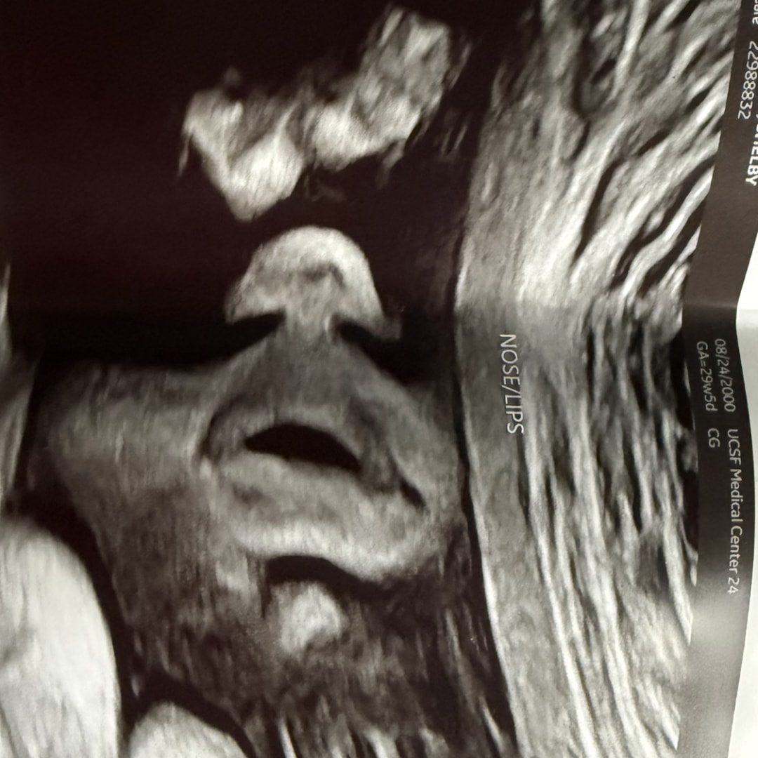 Photo shared by Shelby for their Babylist baby registry.