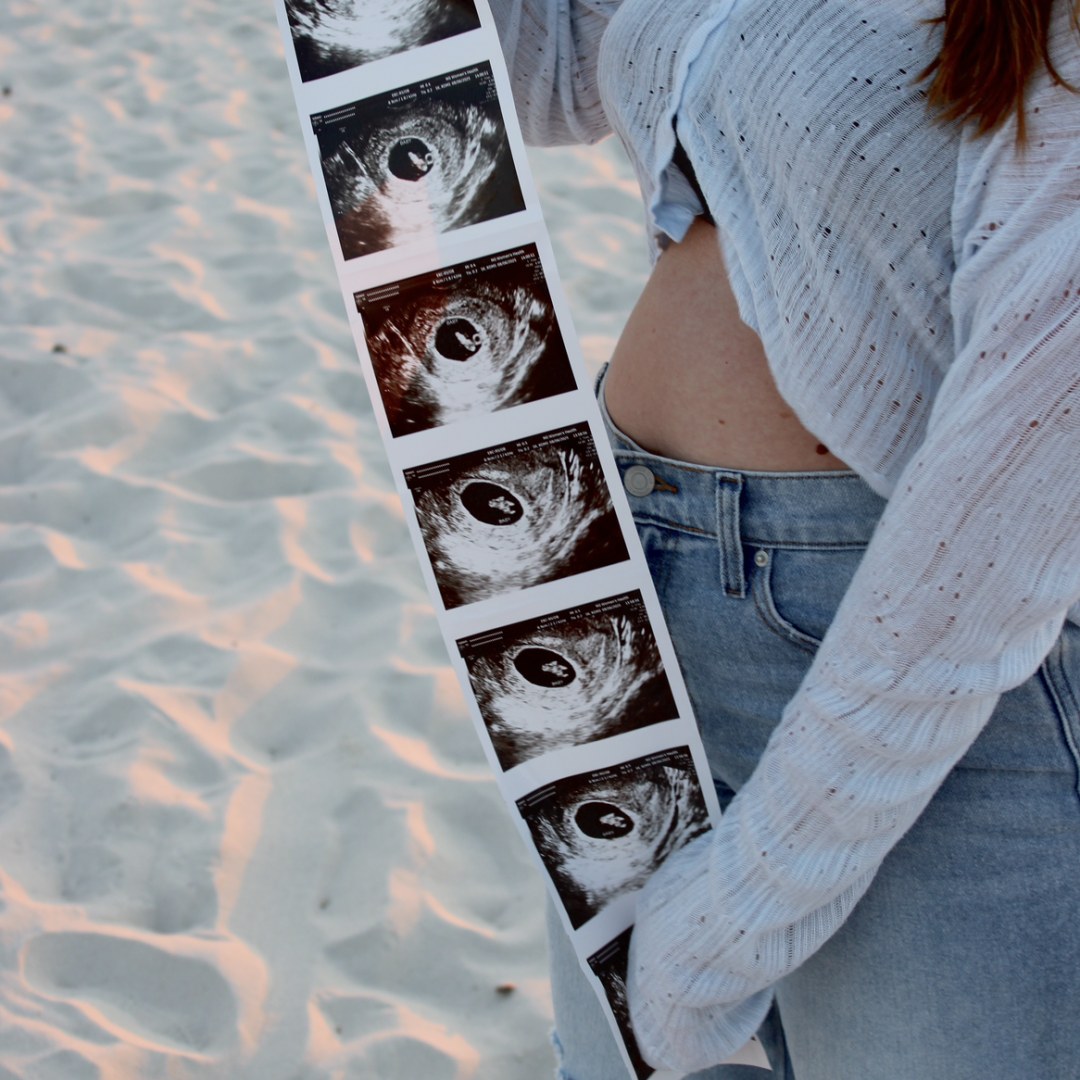 Photo shared by Kiersten for their Babylist baby registry.