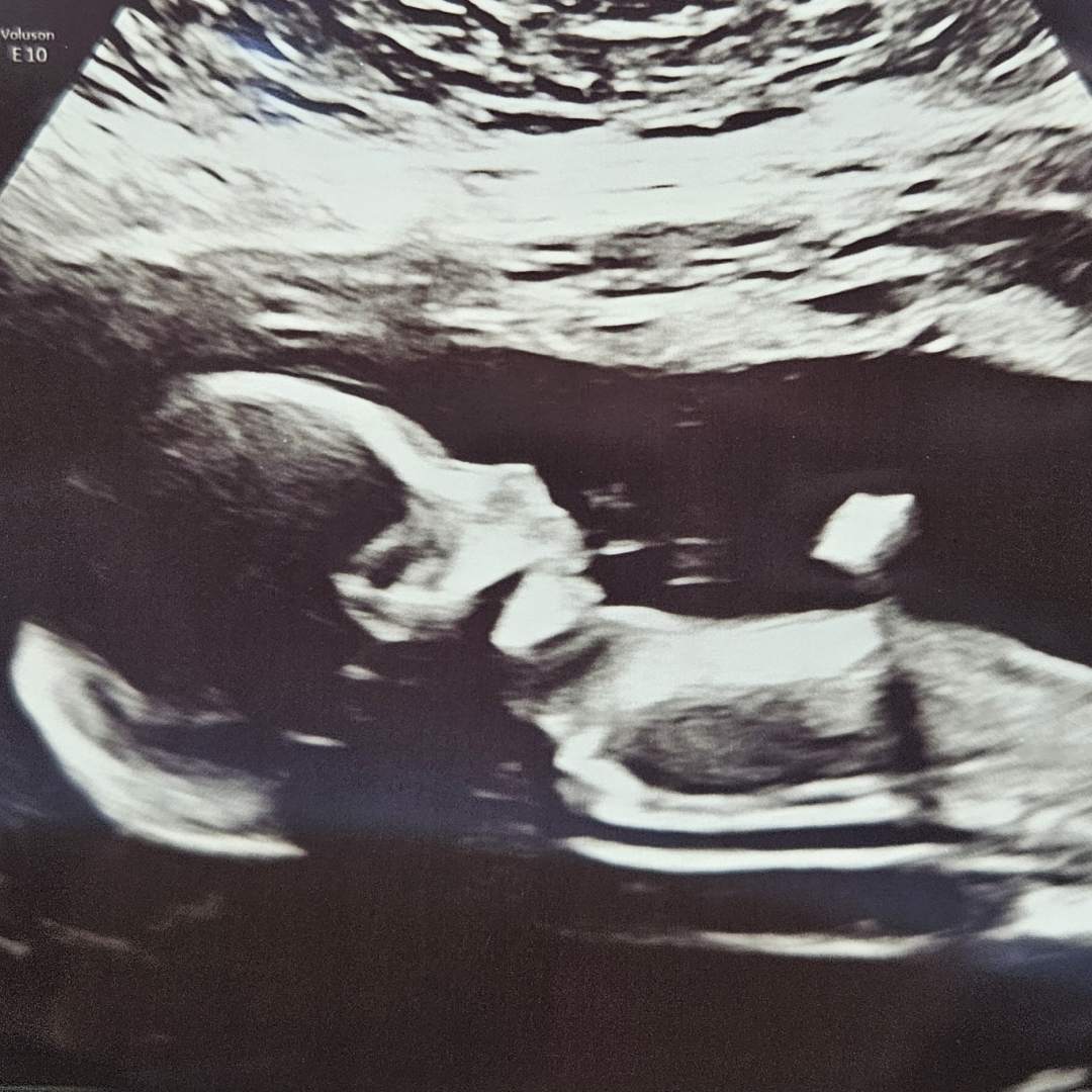 Photo shared by Christina for their Babylist baby registry.