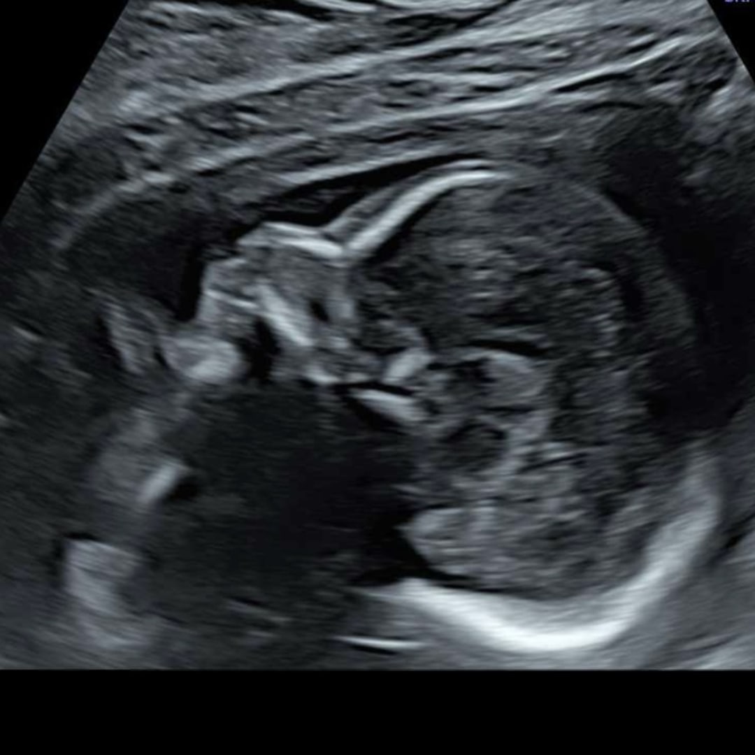 Photo shared by Eva for their Babylist baby registry.