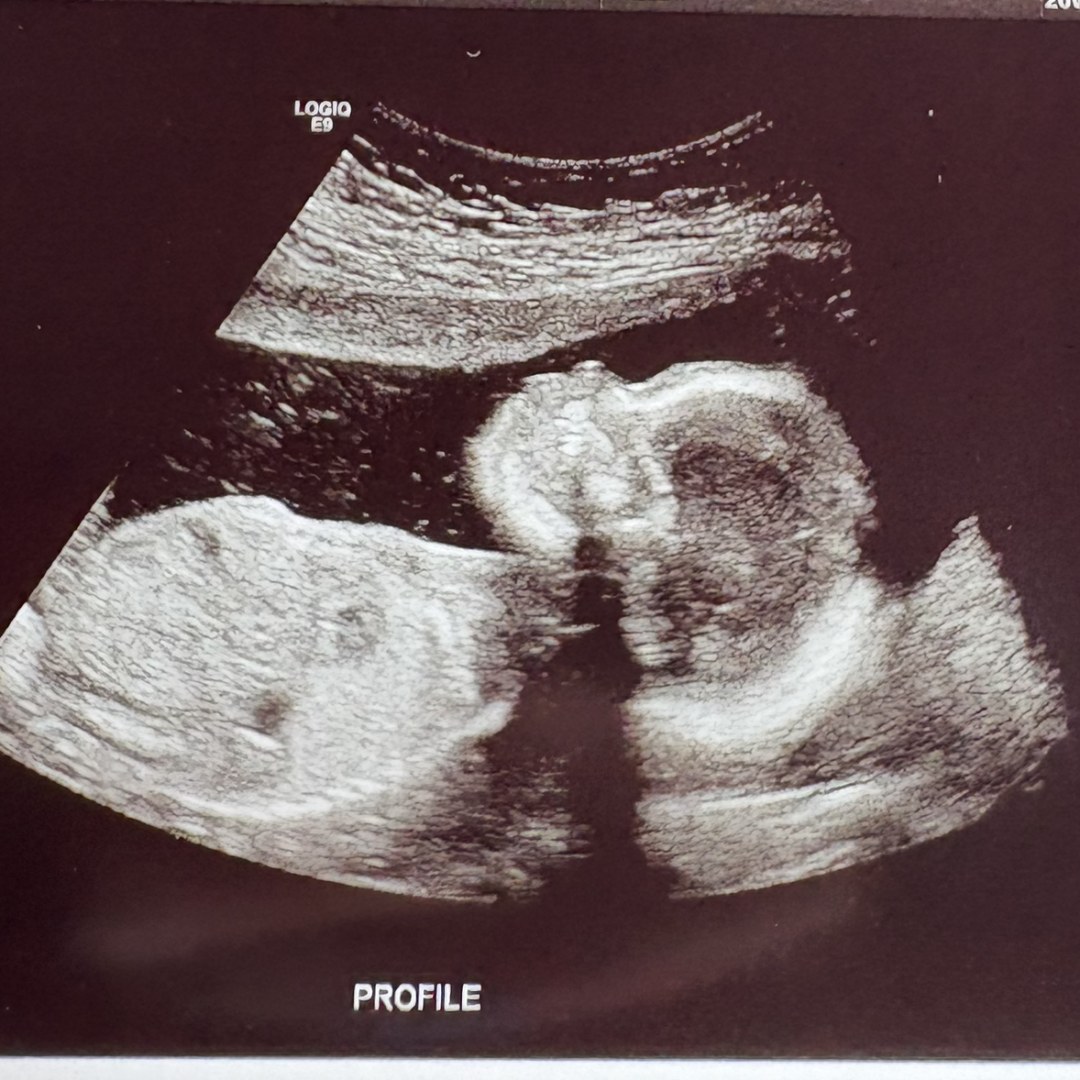 Photo shared by Katrina for their Babylist baby registry.