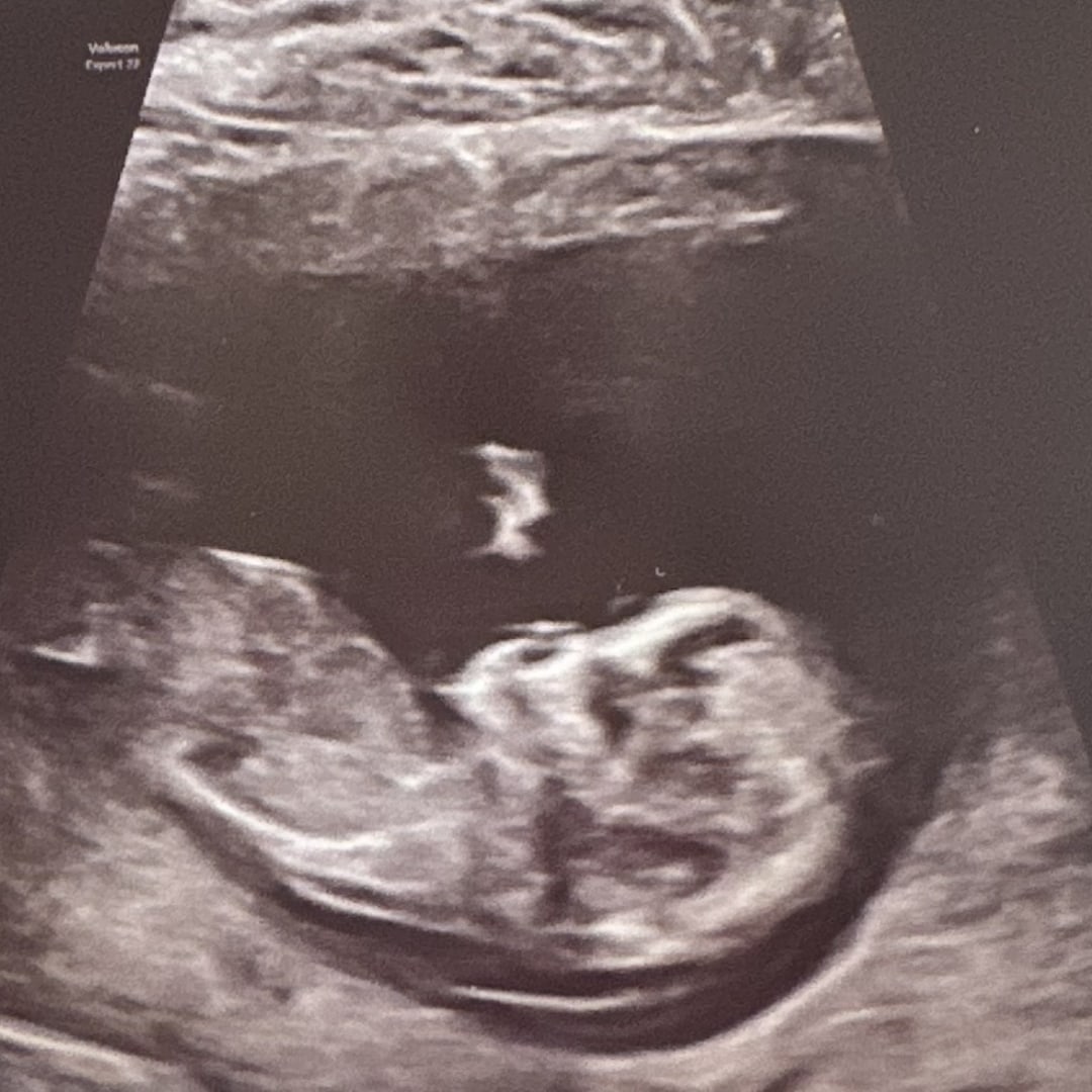 Photo shared by Chelsea and Blaise for their Babylist baby registry.