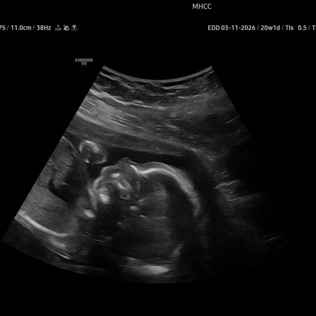 Photo shared by Brenna for their Babylist baby registry.