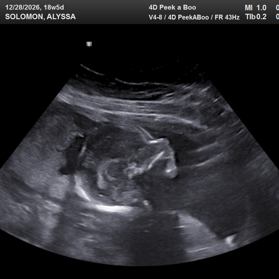 Photo shared by Alyssa for their Babylist baby registry.