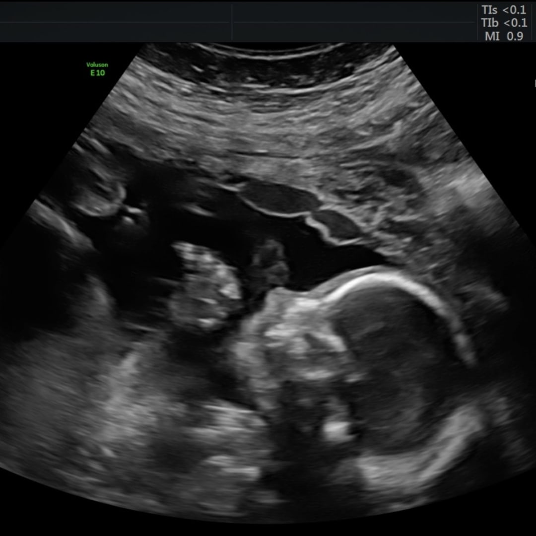 Photo shared by Amanda for their Babylist baby registry.