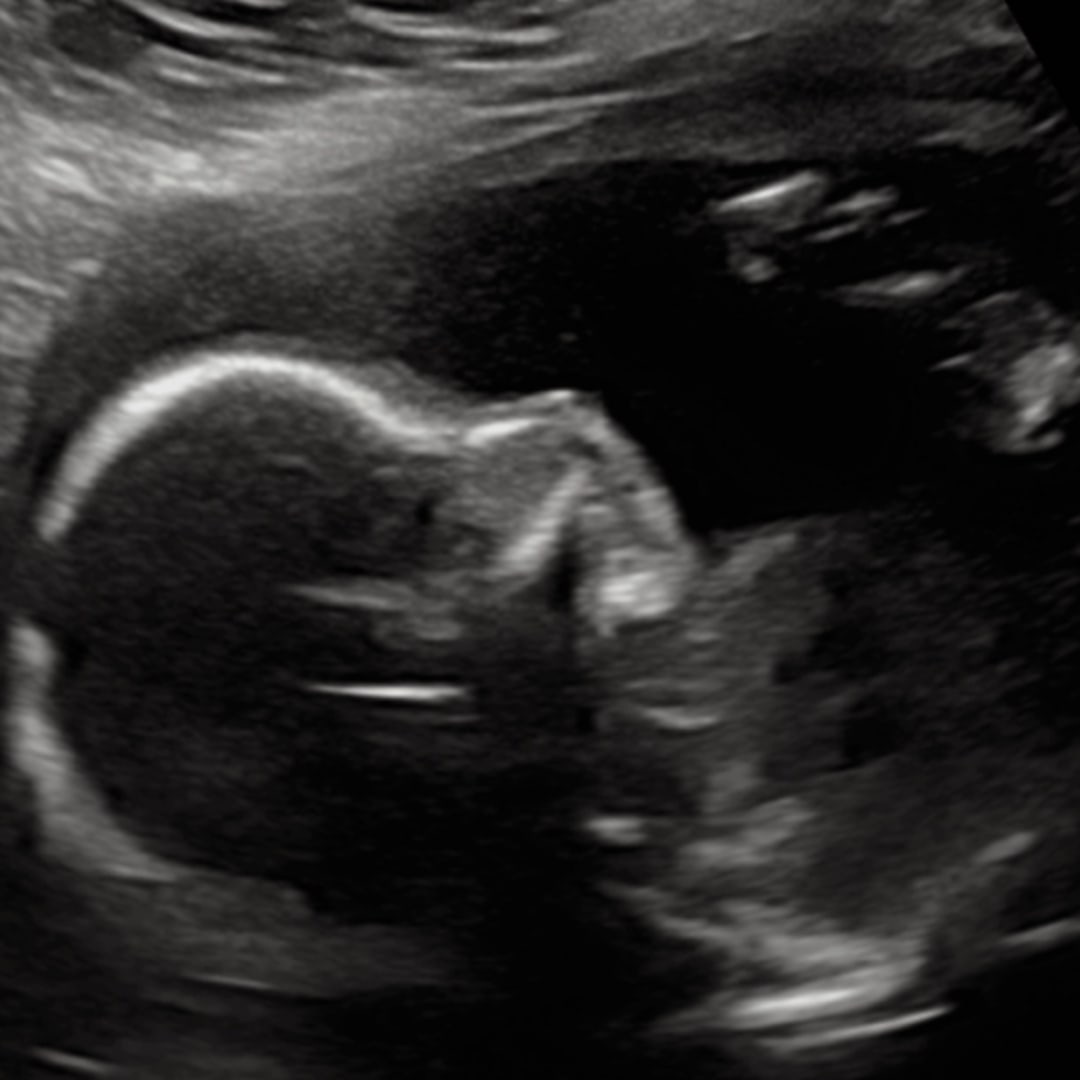 Photo shared by Heather for their Babylist baby registry.