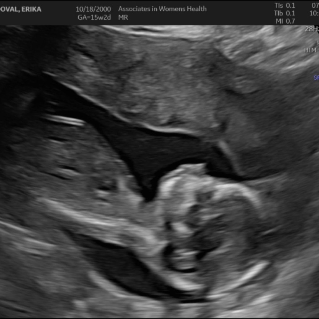 Photo shared by Erika for their Babylist baby registry.