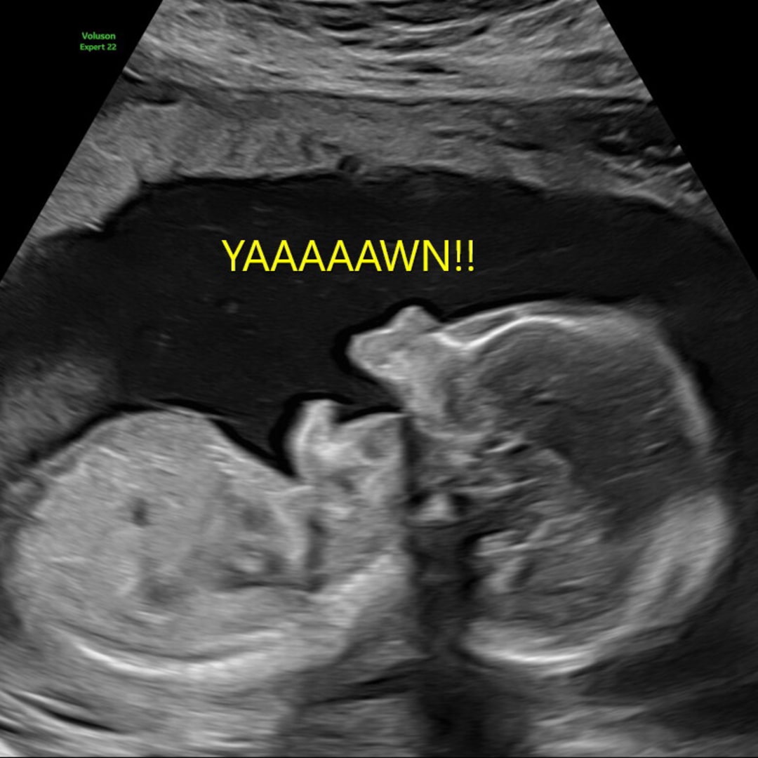 Photo shared by Abbey for their Babylist baby registry.
