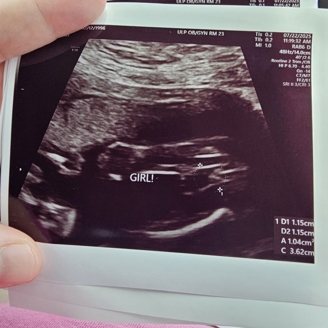 Photo shared by Kelsey for their Babylist baby registry.