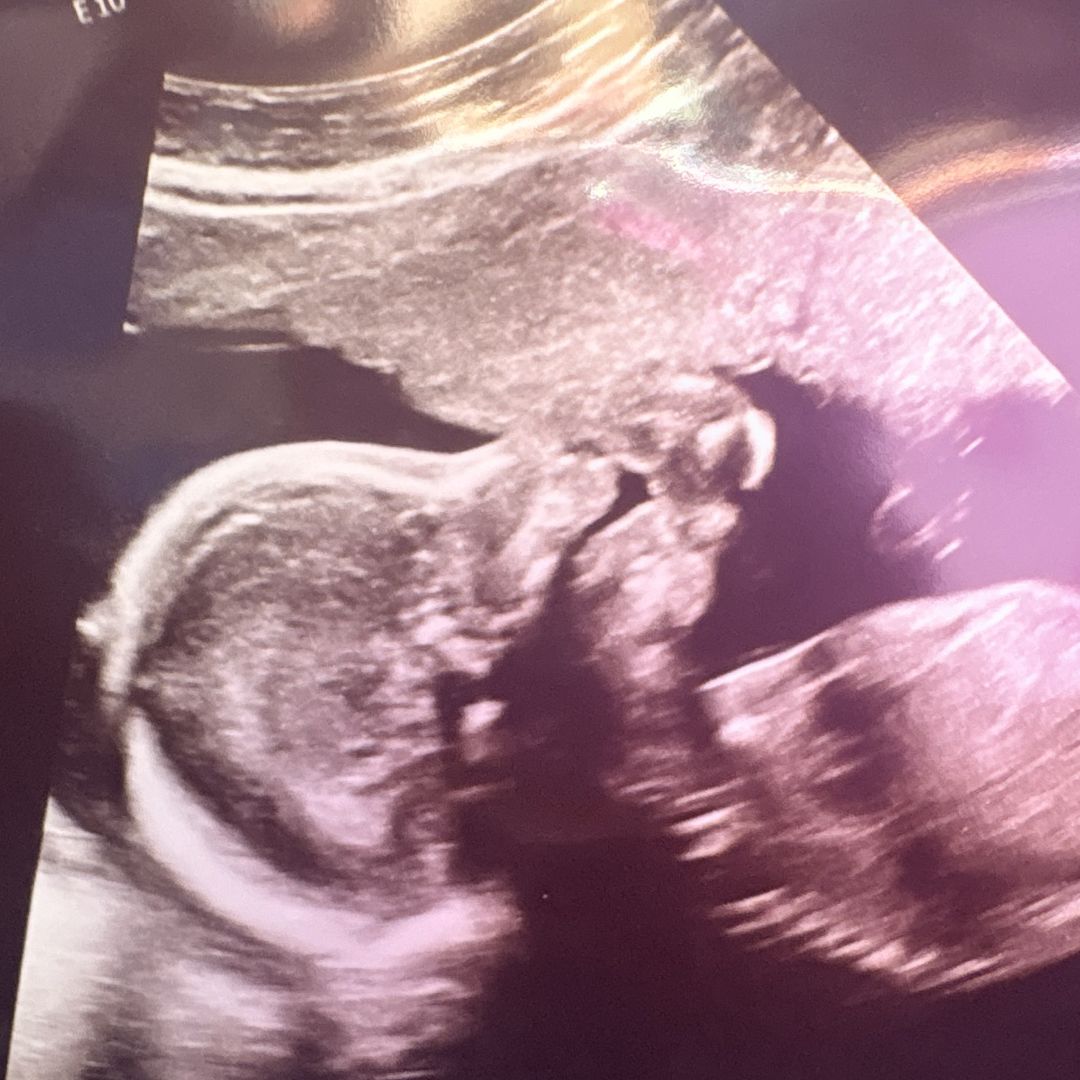 Photo shared by Jessica for their Babylist baby registry.