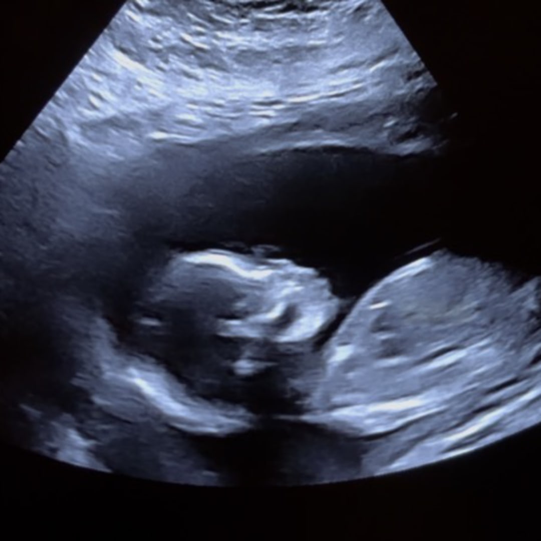 Photo shared by Daniella for their Babylist baby registry.