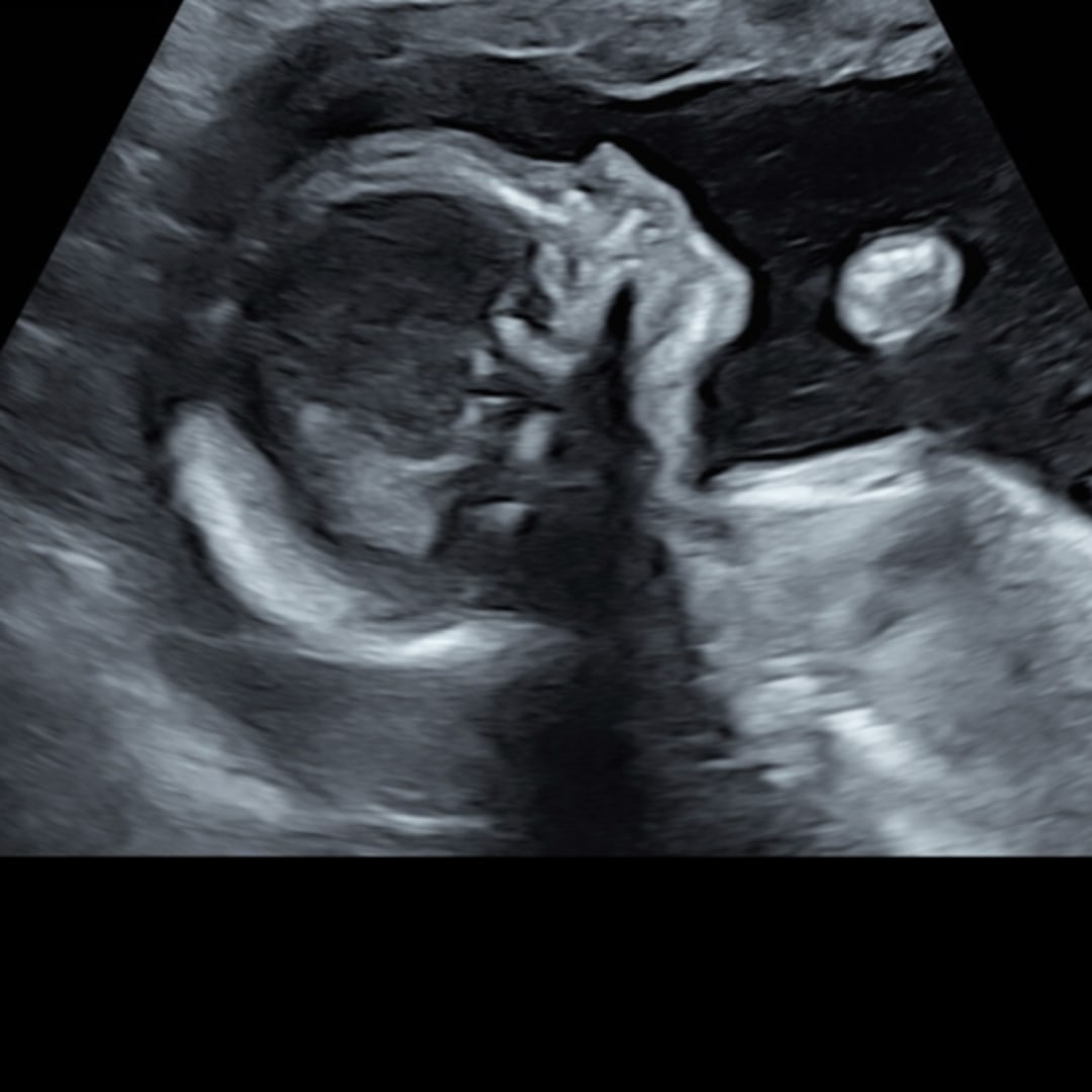 Photo shared by Mikayla for their Babylist baby registry.