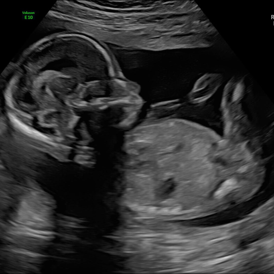 Photo shared by Marianna for their Babylist baby registry.