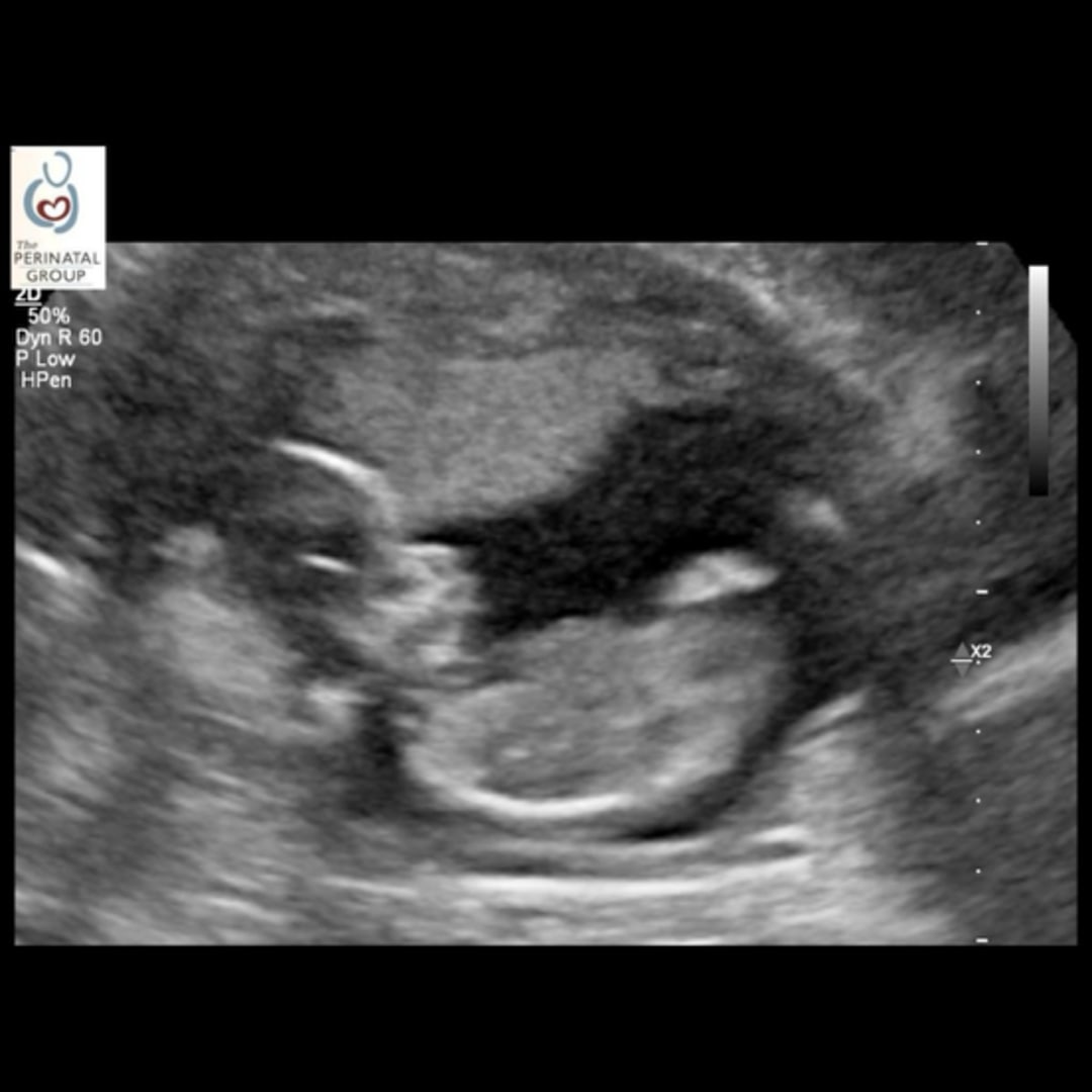 Photo shared by Shanna for their Babylist baby registry.