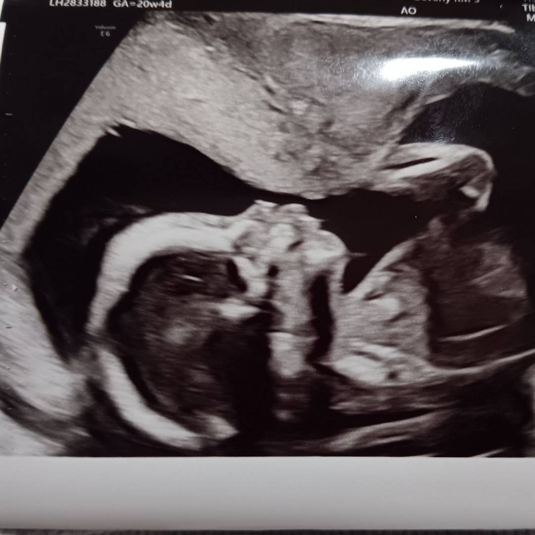 Photo shared by Jaylei for their Babylist baby registry.