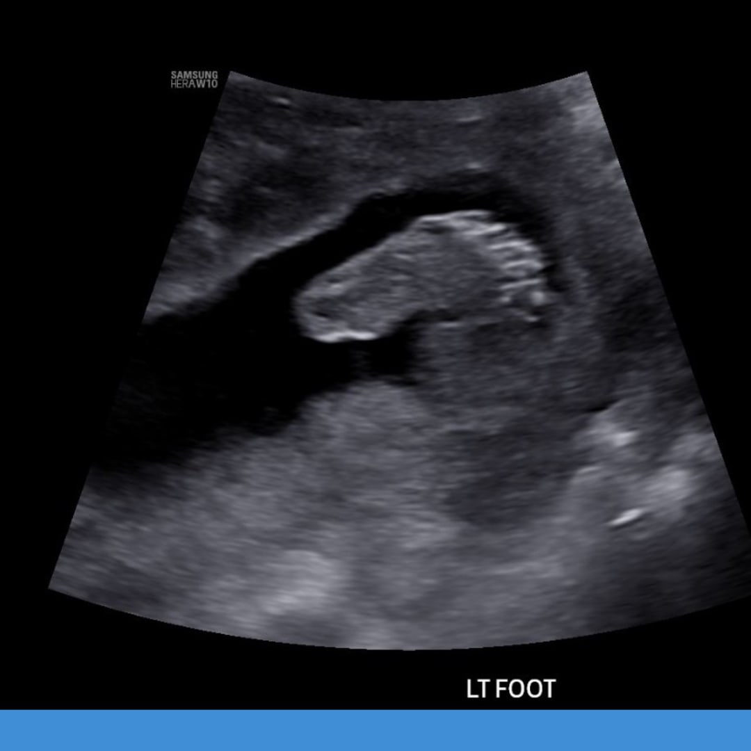 Photo shared by Dayany for their Babylist baby registry.