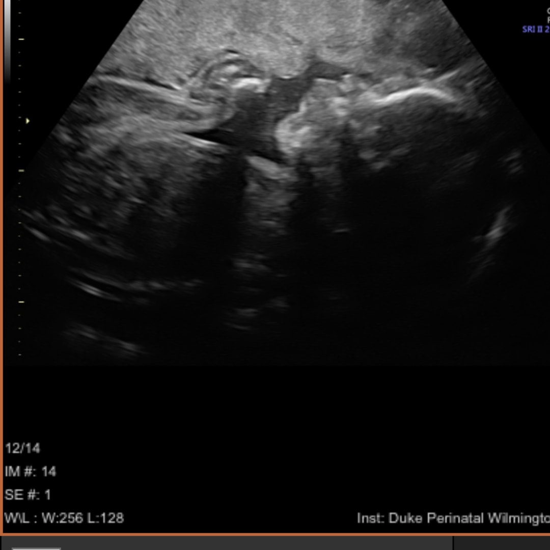Photo shared by Marion for their Babylist baby registry.