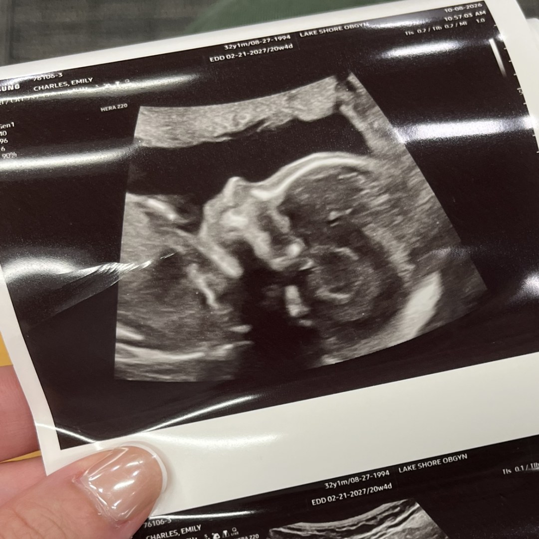Photo shared by Emily for their Babylist baby registry.