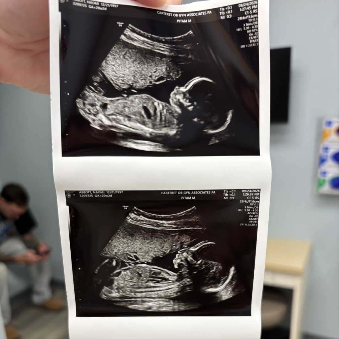 Photo shared by Skye for their Babylist baby registry.